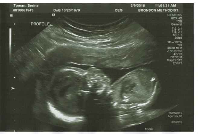 Baby 7 Mar-16 3